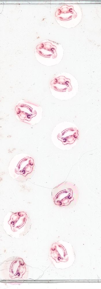Media type: image; histological serial section;  shows cataloged_item Special Collections 3992